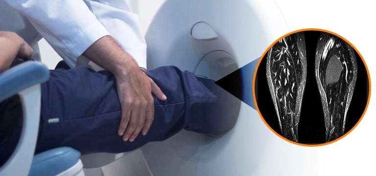 MRI Leg Scan: Know its purpose, Procedure, significance, and outcome